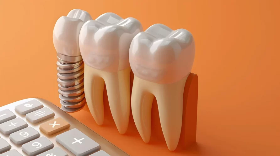 インプラントが保険適用になる条件は？損をしないために知っておきたい情報を紹介